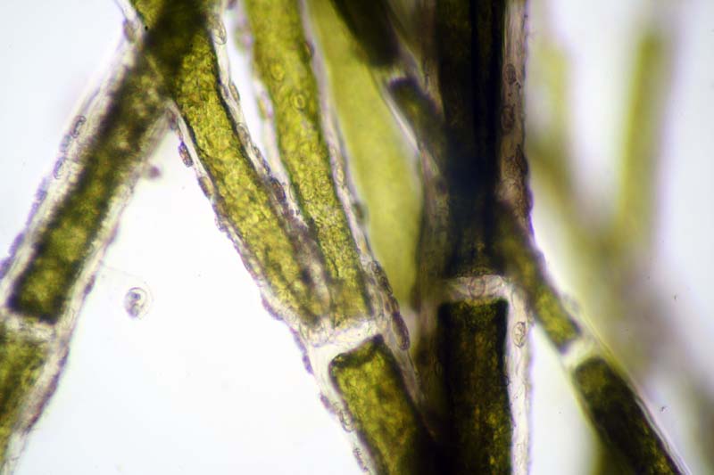 Cocconeis cells on cladophora