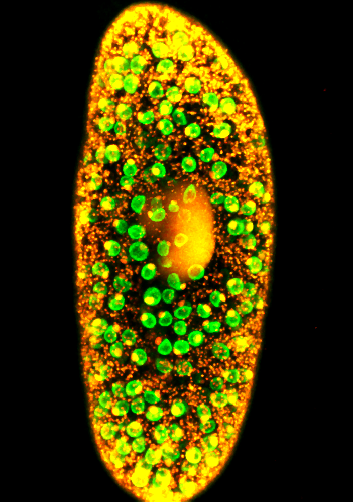 Image2 Fluorescence microscopy image of Paramecium bursaria showing Chlorella spp. algal symbionts in green. Credit Dr Peter Stilwell