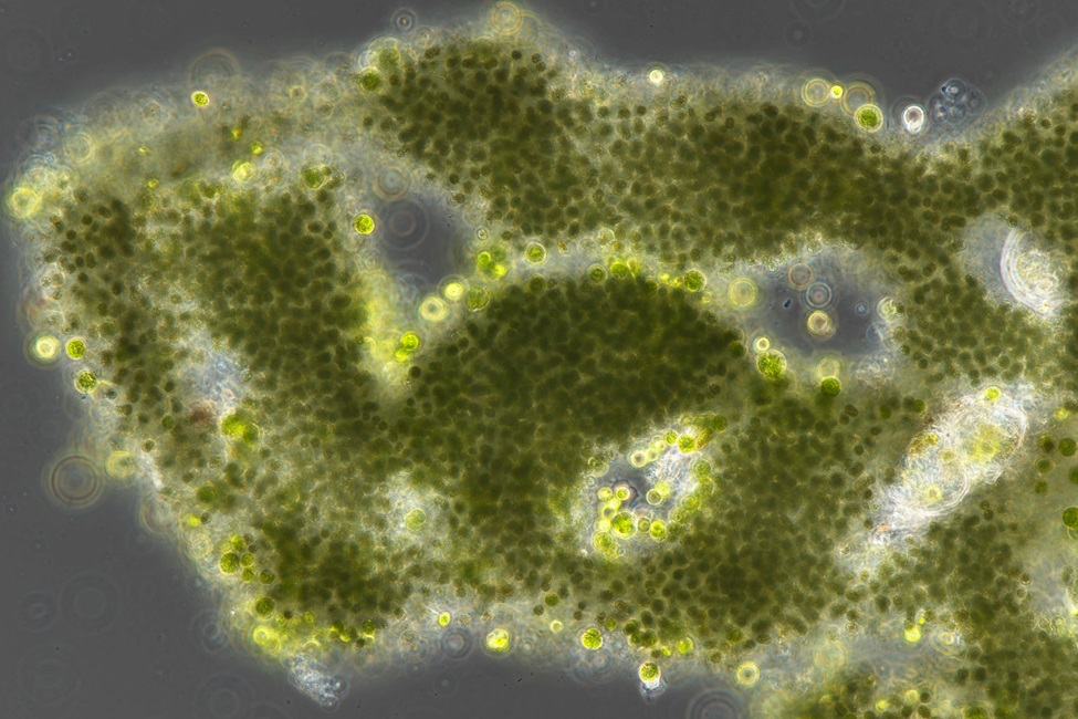 image2 microcystis microscope newsdek