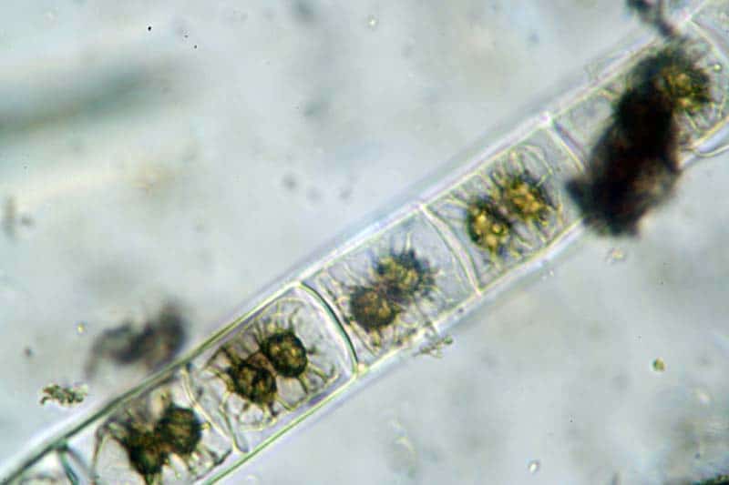 Zygnema sp