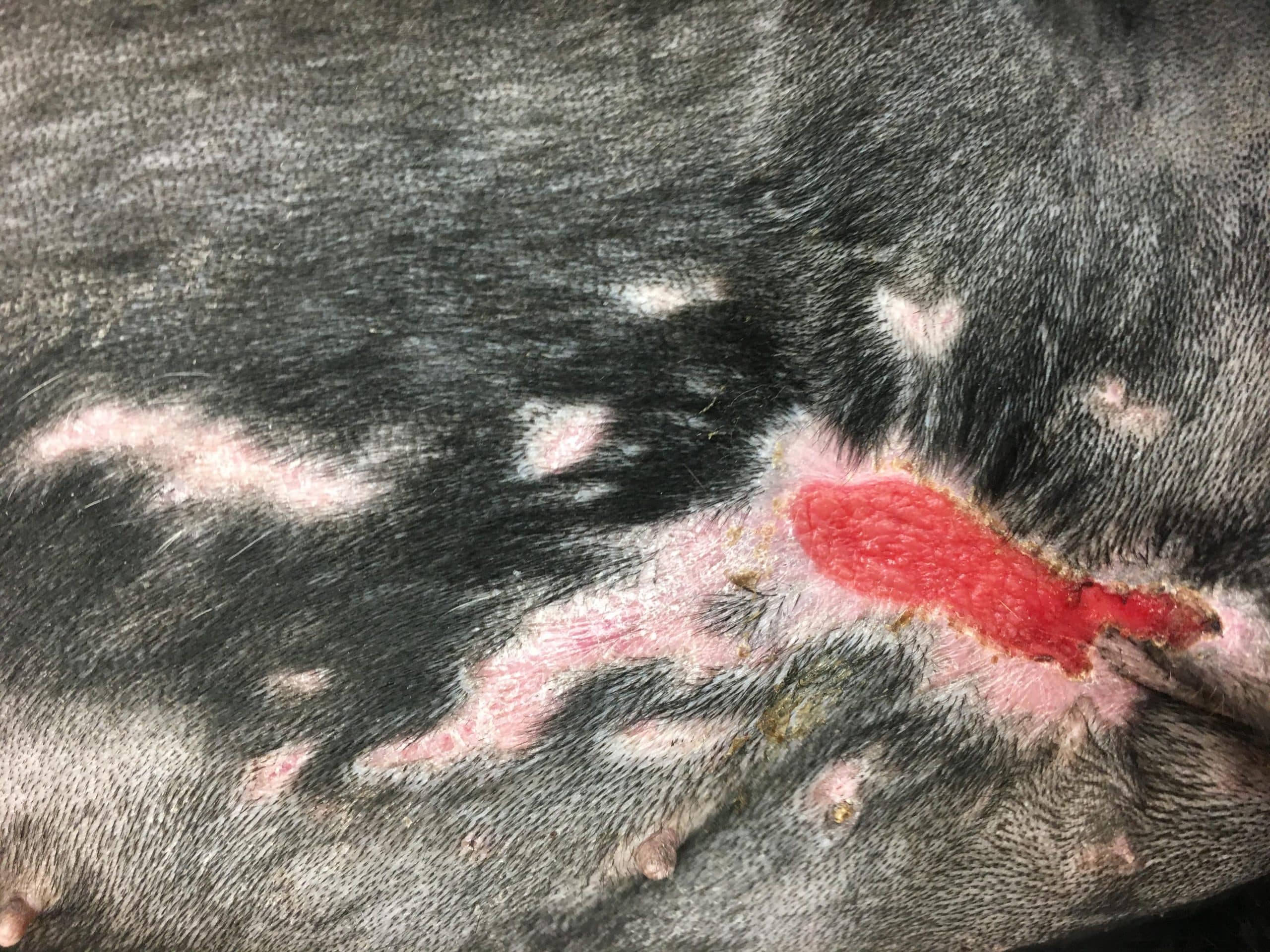 EM 2 stella and her healed burns