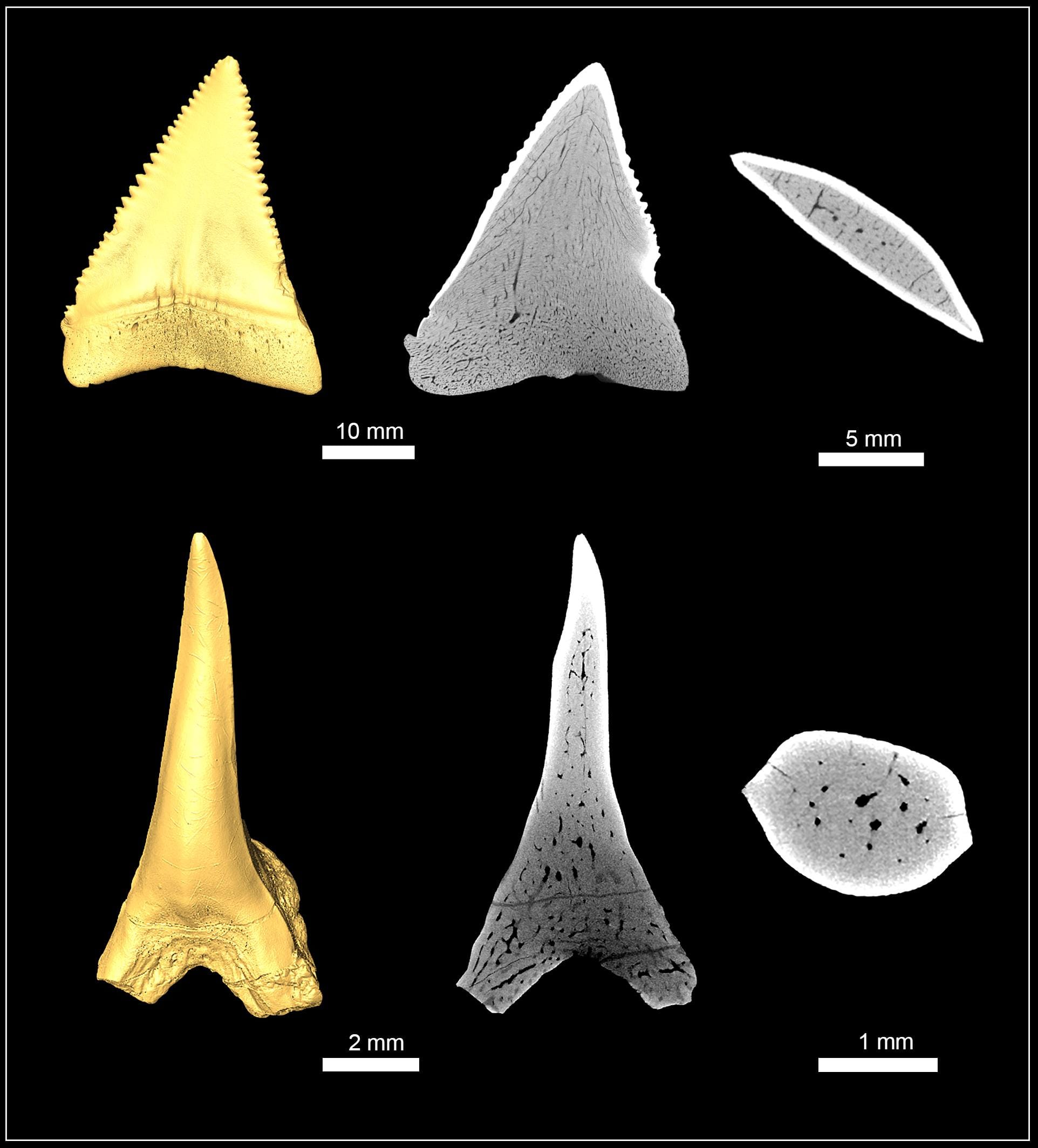 Fig 1 CT Scans