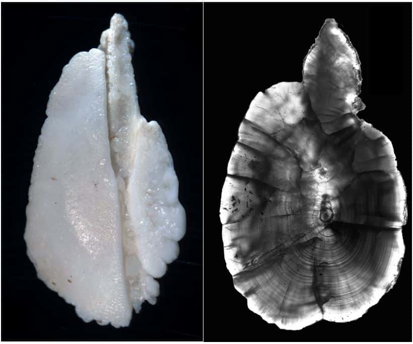 em1 Whole vs sectioned oto