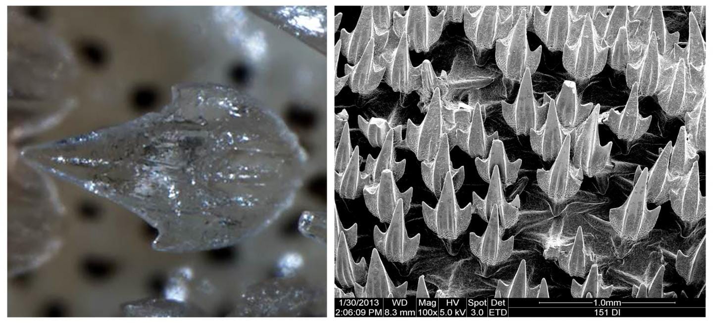 Em 1 shark denticles