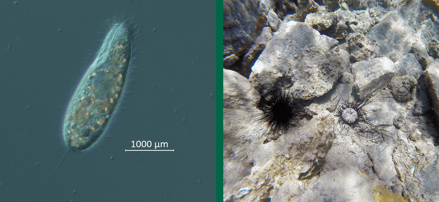 ciliate culture viewed under the microscope dasc affected sea urchin and grossly normal sea urchin