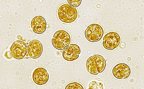 Image2 2 Unicellular symbiont algae of a reef coral showing growth by cell division Credit Wiedenmann DAngelo University of Southampton