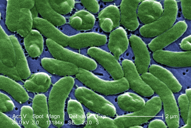 Image2 Vibrio vulnificus 01