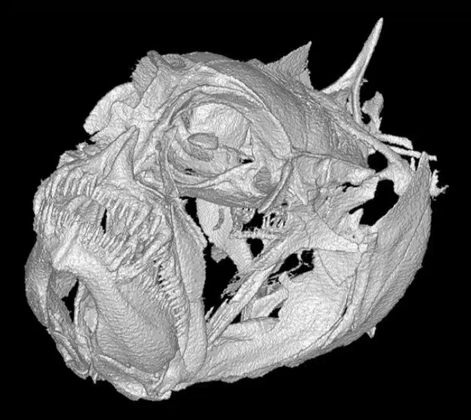 Image2 CT Scan 2