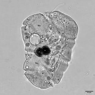 Confocal microscope image of a live Polykrikos kofoidii cell. The nuclei (“Nu”), nematocysts used for hunting (black arrows), and ingested prey cells (asterisks) are visible. 