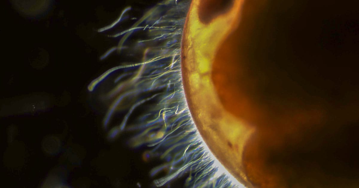 The exterior surface of a late-stage lobster embryo covered by filamentous bacteria at 400x magnification.