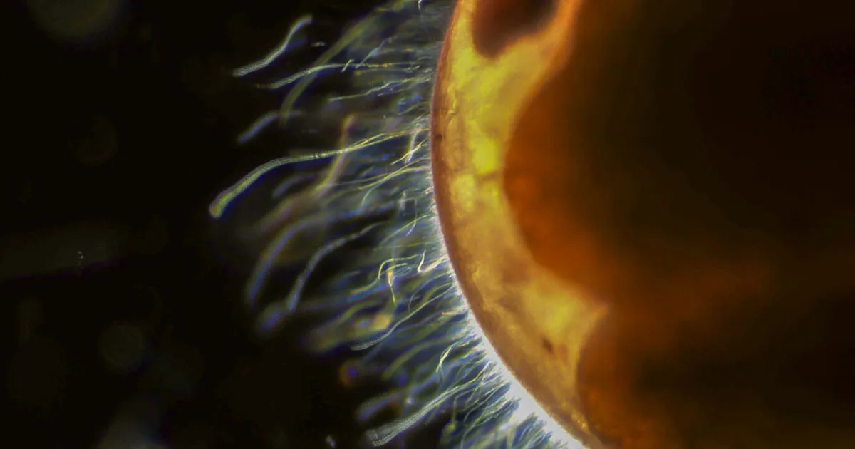 The exterior surface of a late-stage lobster embryo covered by filamentous bacteria at 400x magnification.