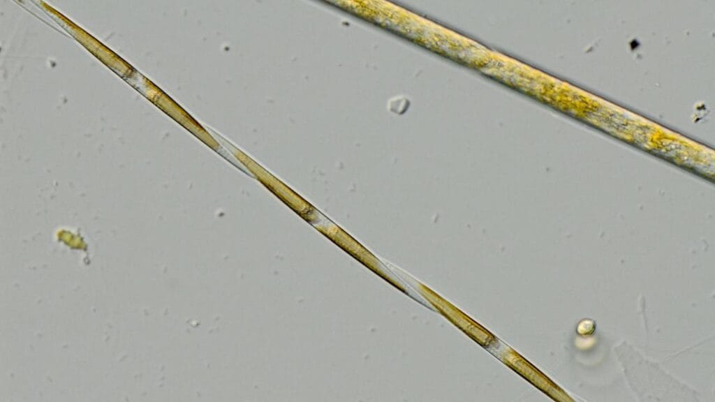 Pseudo-nitzschia are a common component of the phytoplankton community along Europe’s Atlantic coast and the North Sea, and a number of species produce the toxins responsible for amnesic shellfish poisoning. 