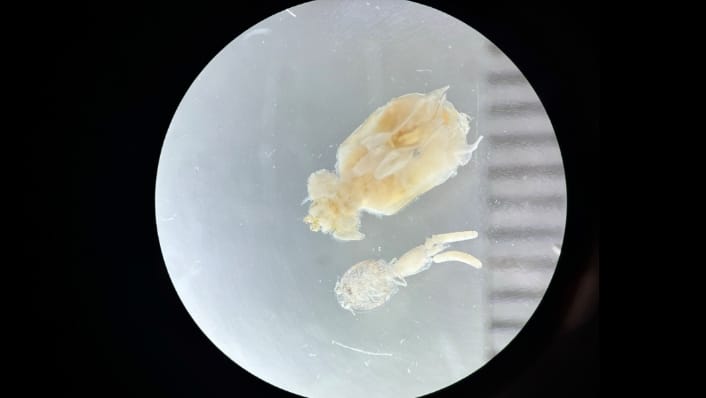Parasites found in the gills of Mangrove Jacks, revealed under the microscope. 