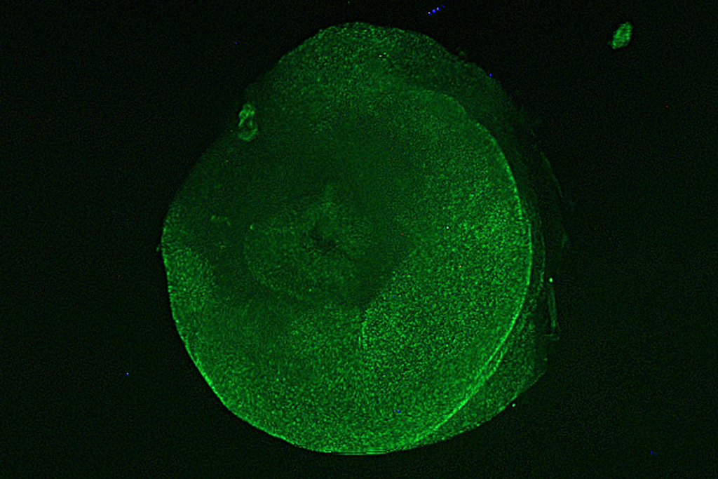 Microscopy image of an excised tube foot stained with 5-bromo-2′-deoxyuridine showing cell differentiation, with denser green coloring reflecting areas of more active cellular processes. 