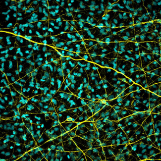 A microscopic image of a bat sea star ovarian nerve plexus.