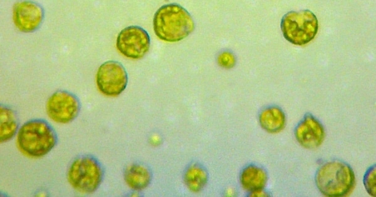 Schizochytrium sp. cells. (Image credit: Dan Ward)