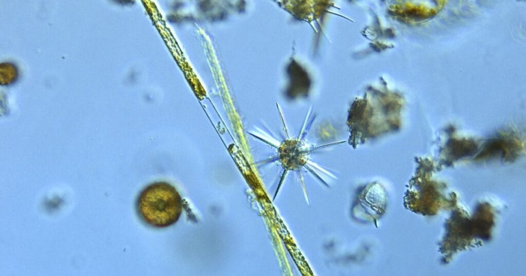 Phytoplankton under a microscope. (Credit: Marine Biological Association)