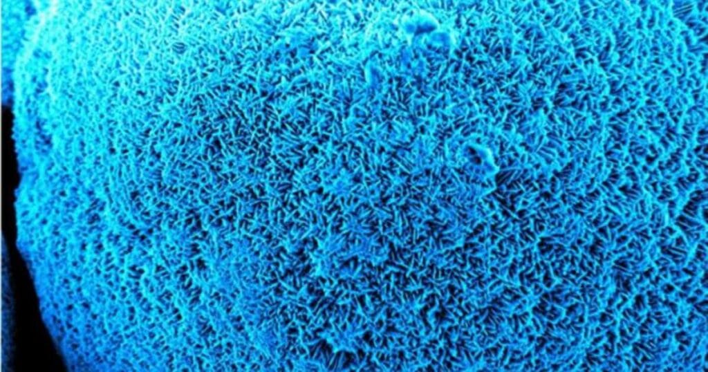 Aragonite crystals produced by the bacteria to protect metal surfaces from corrosive seawater salts. (Image credit: Ilana Kolodkin-Gal)