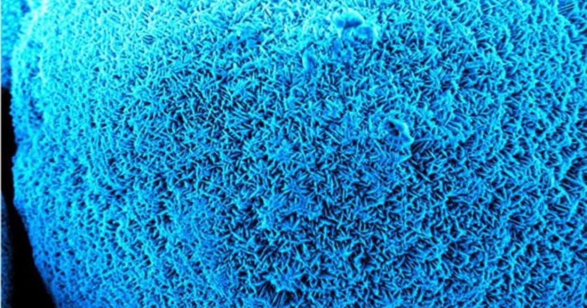 Aragonite crystals produced by the bacteria to protect metal surfaces from corrosive seawater salts. (Image credit: Ilana Kolodkin-Gal)