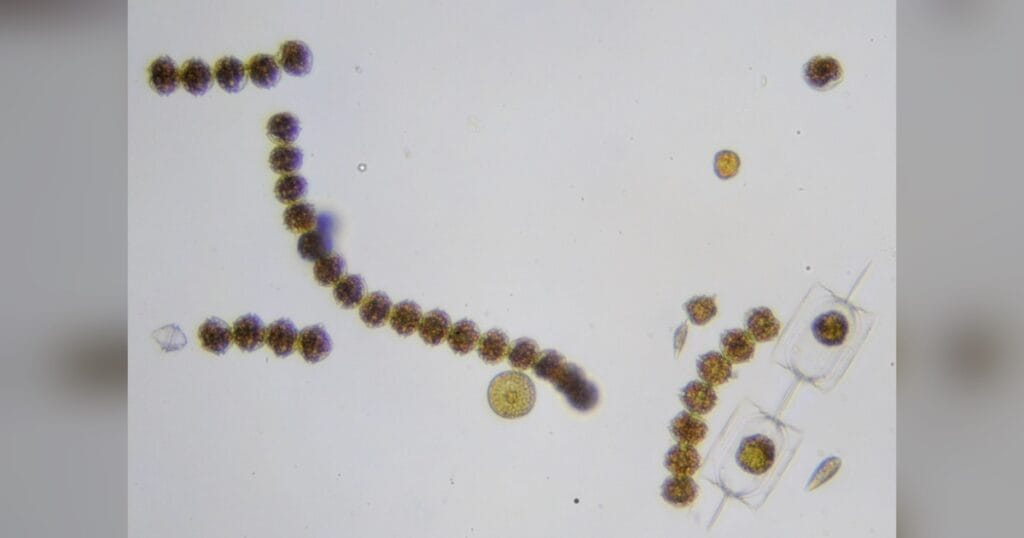 Alexandrium catenella. (Credit: Sarka Martinez)
