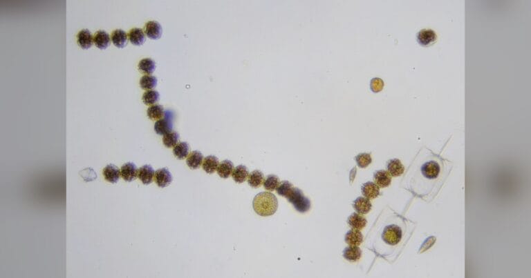 Alexandrium catenella. (Credit: Sarka Martinez)