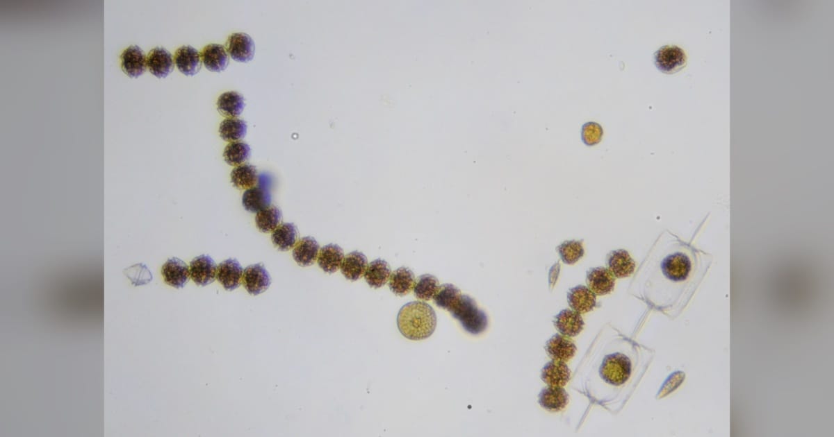 Alexandrium catenella. (Credit: Sarka Martinez)