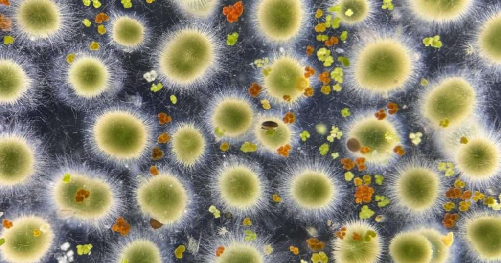 Gloeotrichia echinulata. (Image credit: Peter Countway)