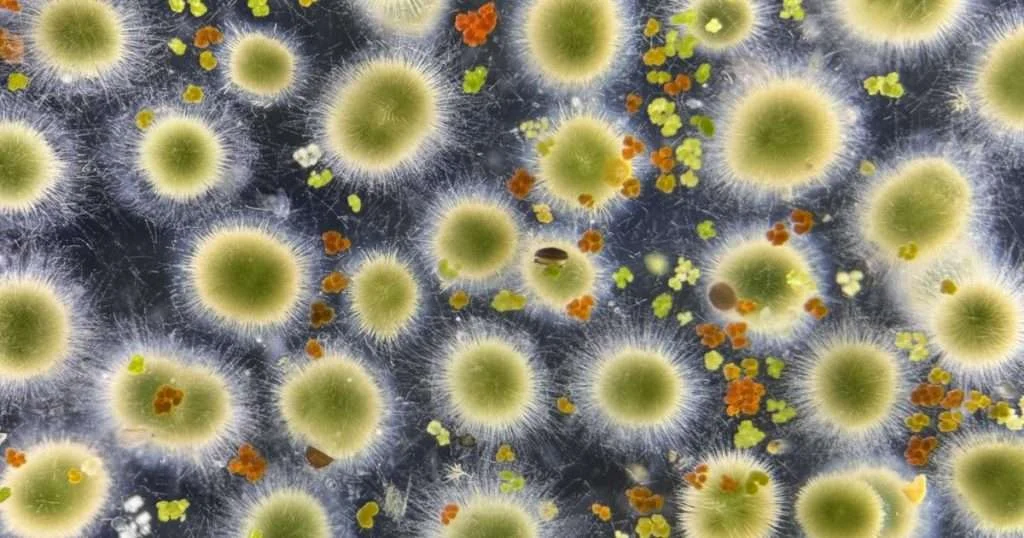 Gloeotrichia echinulata. (Image credit: Peter Countway)