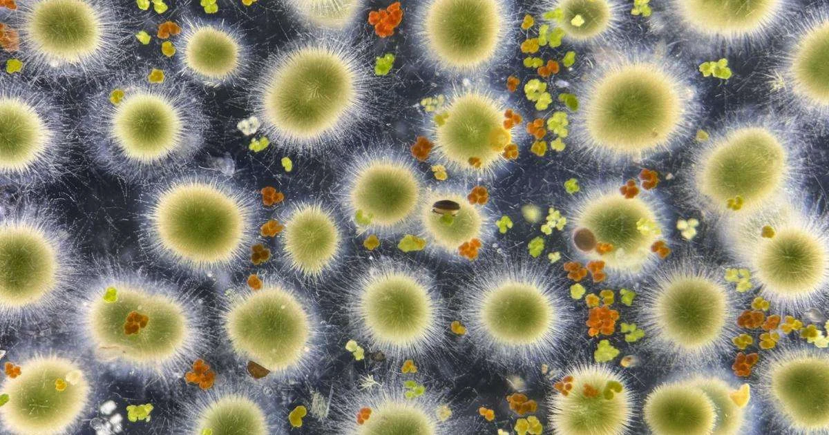 Gloeotrichia echinulata. (Image credit: Peter Countway)