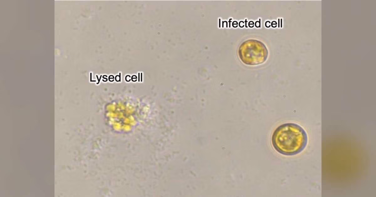 Phytoplankton cells that have lost their mobility due to viral infection (right) and a cell that has died and lysed (left). (Image credit: Hisashi Endo, KyotoU)