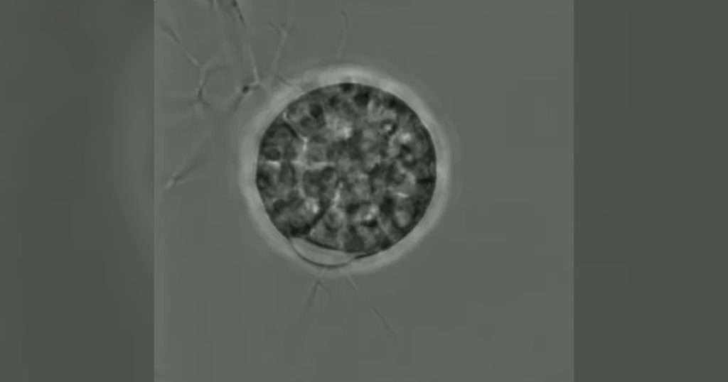Using genetic transformation and confocal microscopy techniques, the researchers were able to visualize key cell wall-forming enzymes during different stages of fungal development. (Image credit: Marine Biological Association)