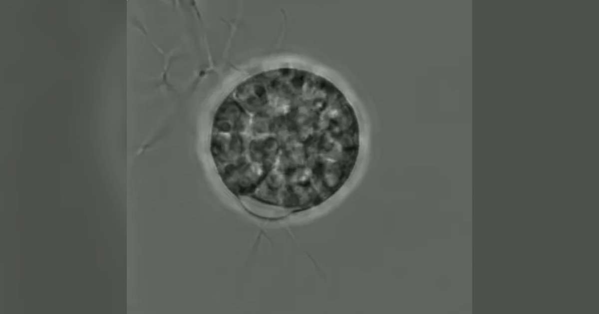 Using genetic transformation and confocal microscopy techniques, the researchers were able to visualize key cell wall-forming enzymes during different stages of fungal development. (Image credit: Marine Biological Association)