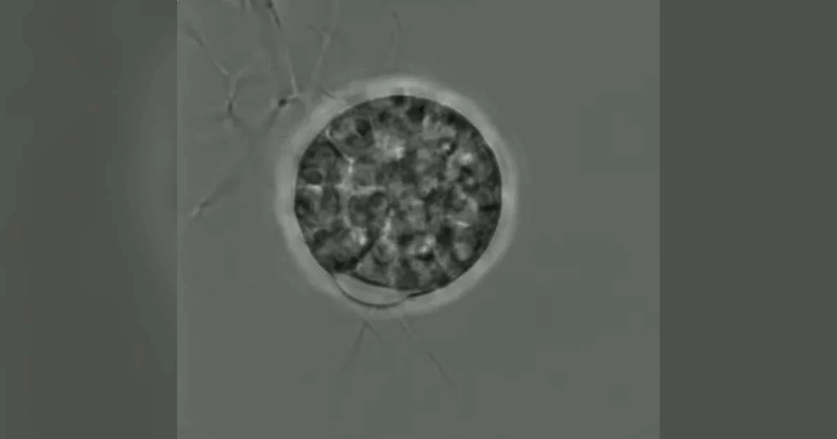 Using genetic transformation and confocal microscopy techniques, the researchers were able to visualize key cell wall-forming enzymes during different stages of fungal development. (Image credit: Marine Biological Association)